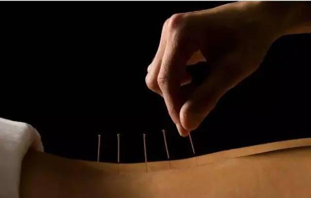 平衡針灸最新視頻，現代應用探索針灸藝術(shù)的新境界