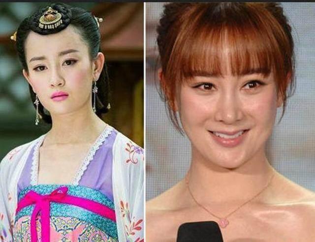 坦然面對整容，女明星的美麗新篇章之旅