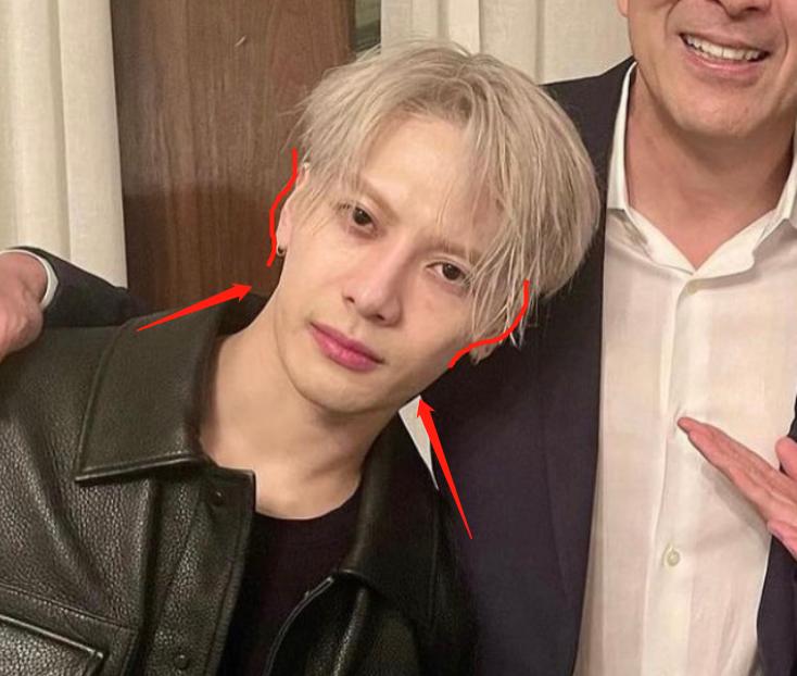 深度解析明星整容后遺癥，觀(guān)點(diǎn)與影響探討