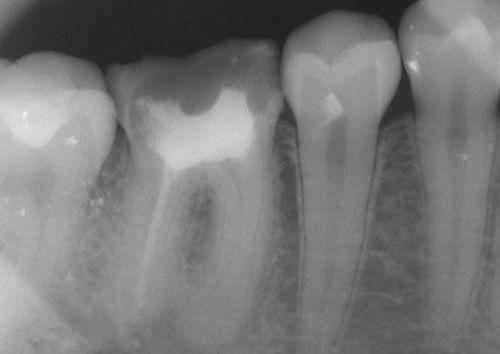 中國再生牙齒研究新進(jìn)展，重塑微笑，科技引領(lǐng)牙齒再生新篇章