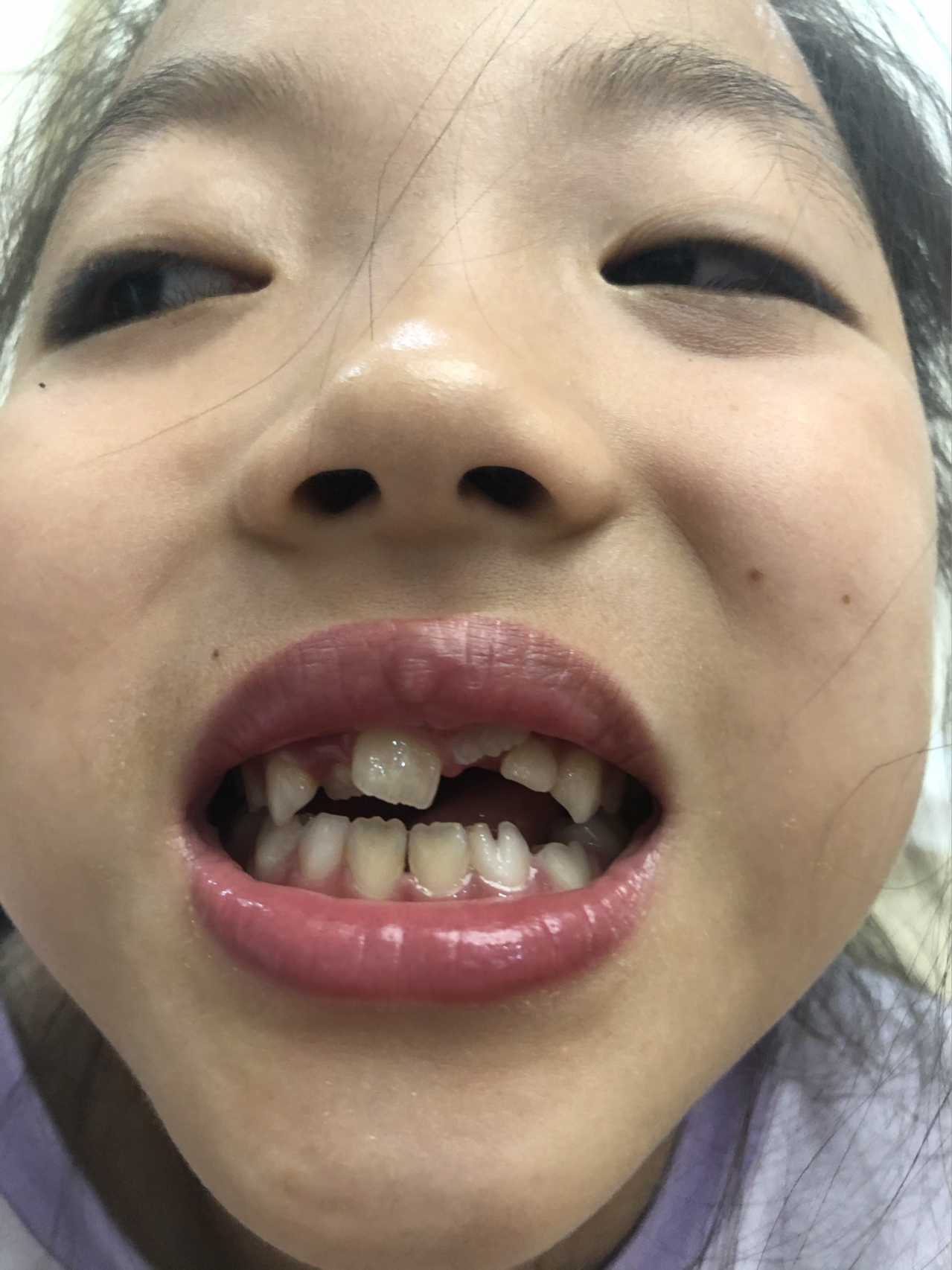 莊最新牙齒技術(shù)揭秘，牙齒美容新選擇